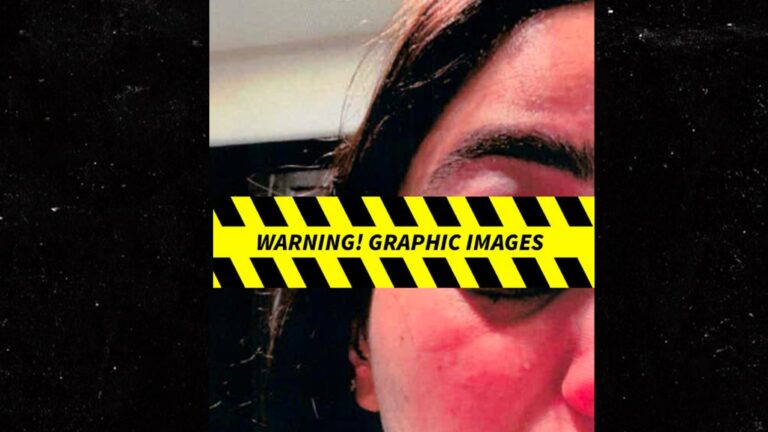 Columbus Short’s Wife Claims He’s Abusing Her, Shares Alleged Injury Photos