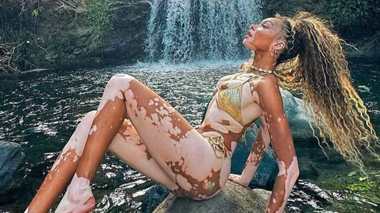 Winnie Harlow Sexy Shots To Kick Off Her 31st Bday!