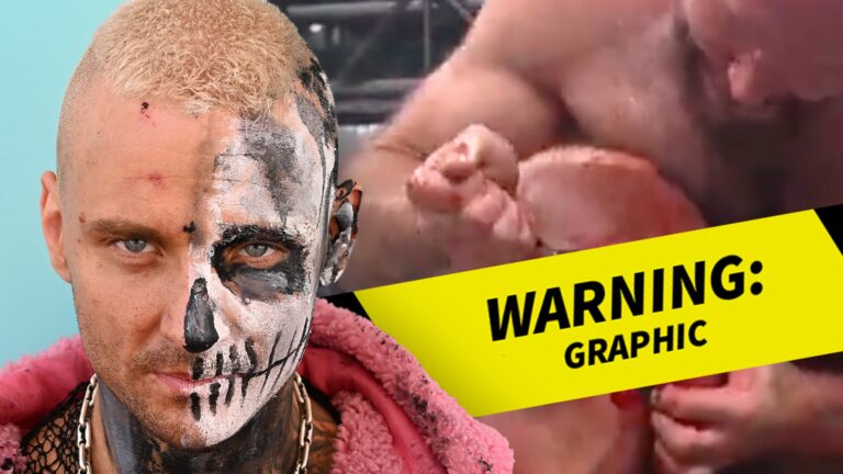 AEW Star Darby Allin Gets Fork Jammed In Ear During AEW Forbidden Door
