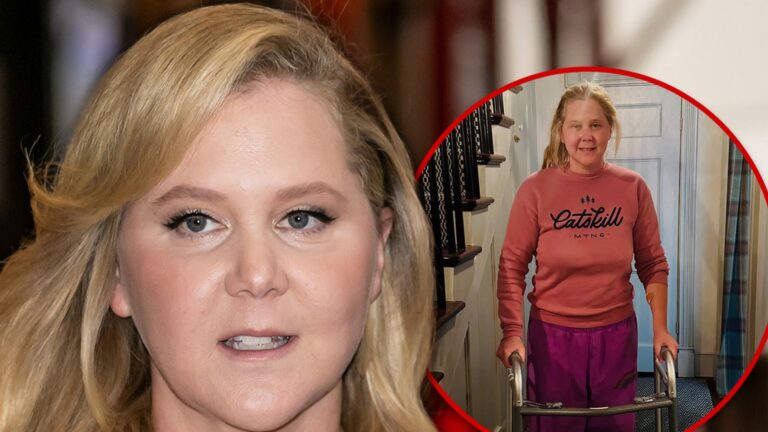 Amy Schumer Shares Photo Using Walker After Spinal Surgery