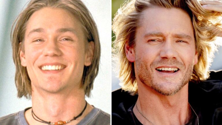 Chad Michael Murray — Good Genes or Good Docs?!